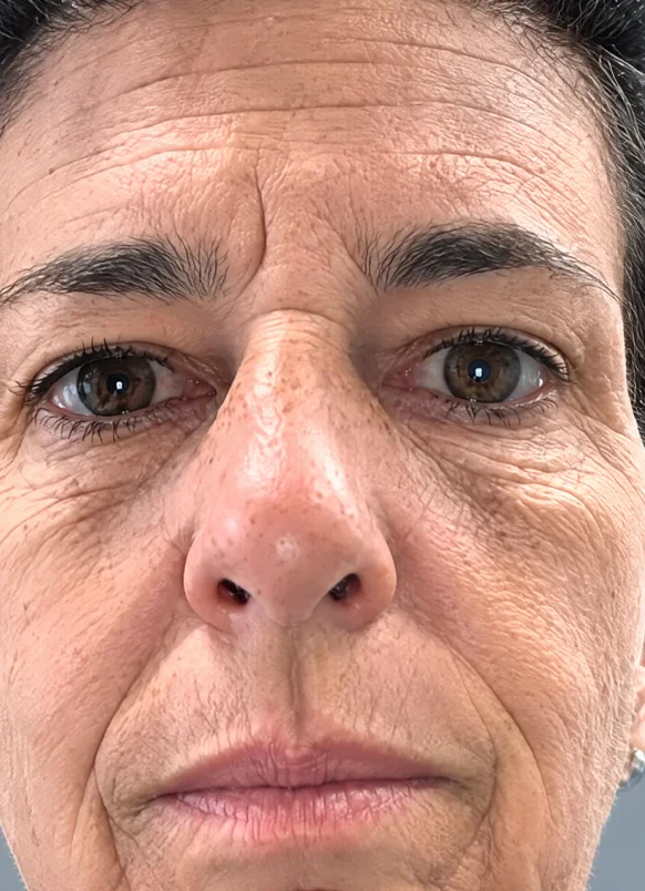 Depois