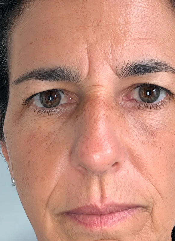 Antes
