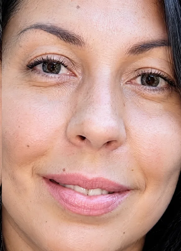 Depois